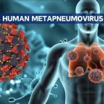 Virus en chine - HMPV- janvier 2025 - freenews - Maroc